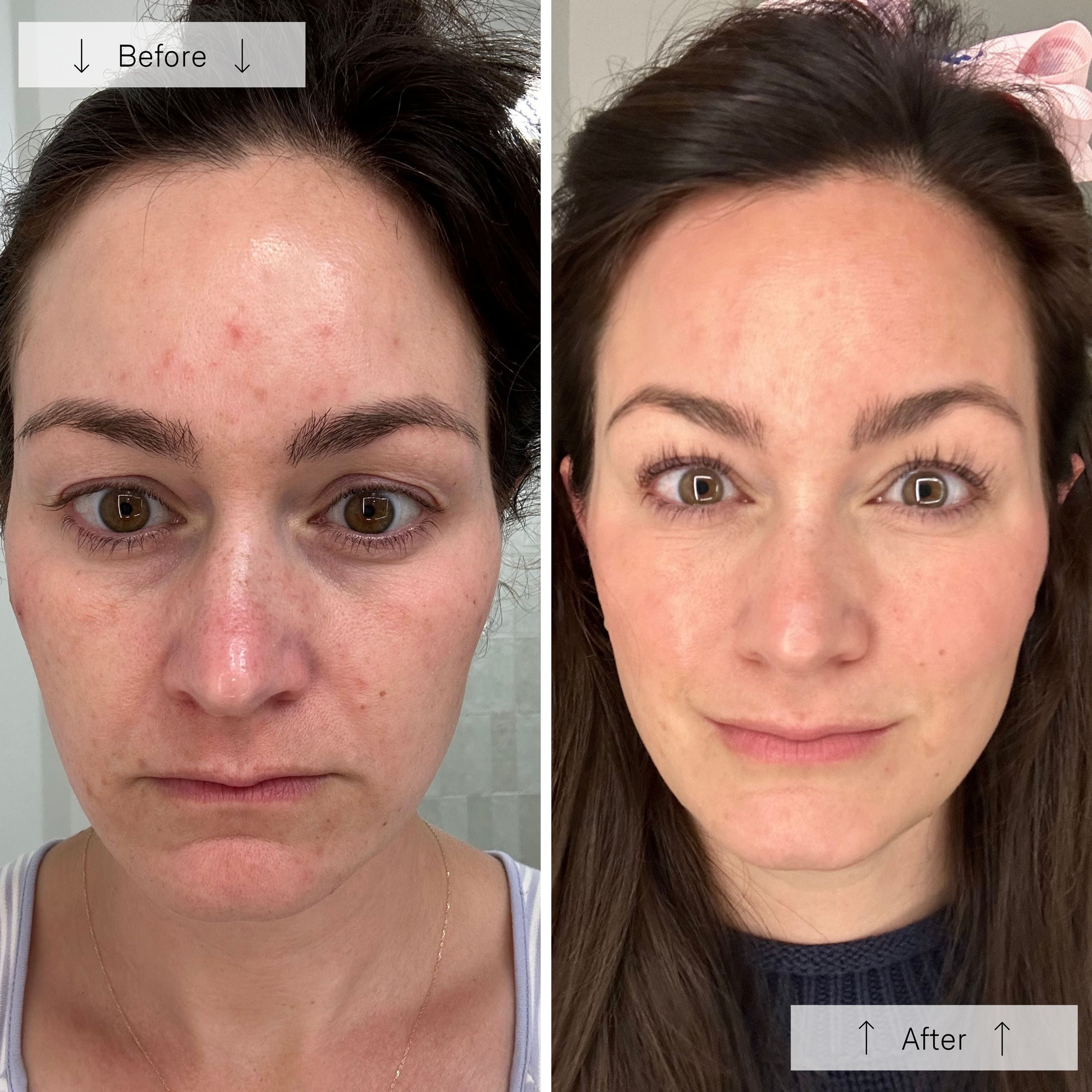 Elyra Light Mask