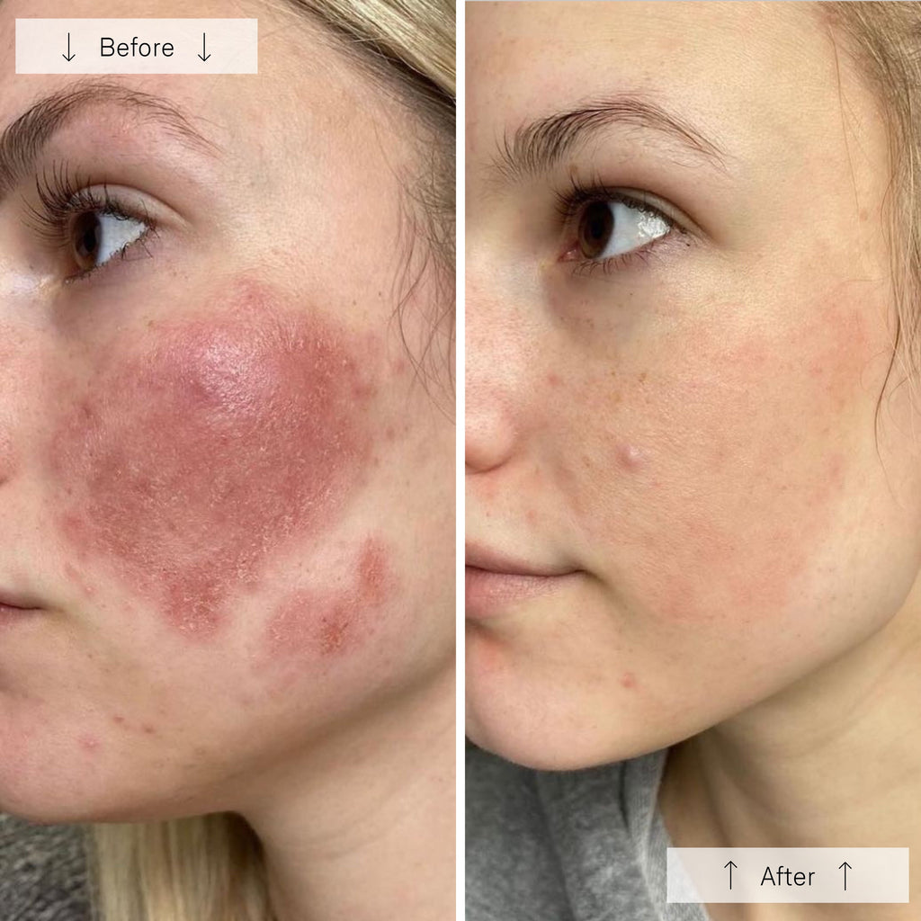 Elyra Light Mask