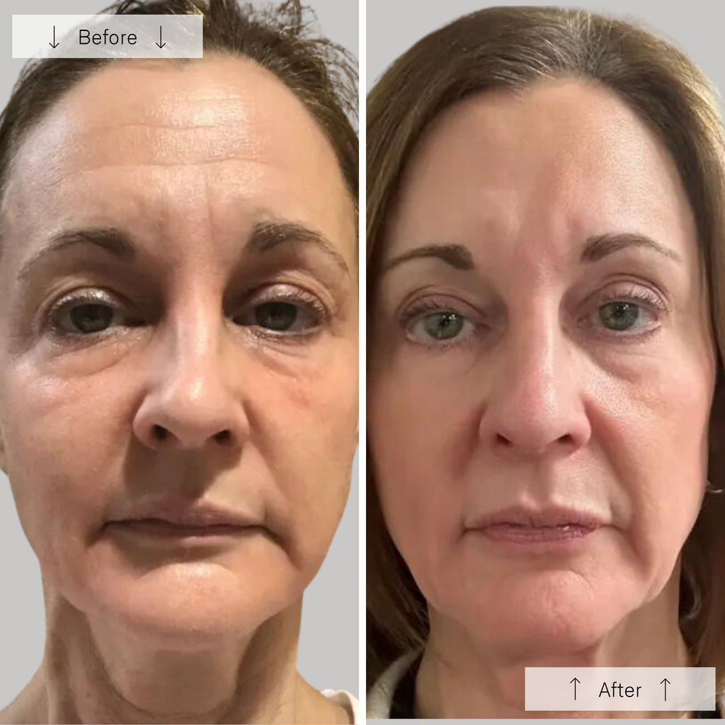 Elyra Light Mask