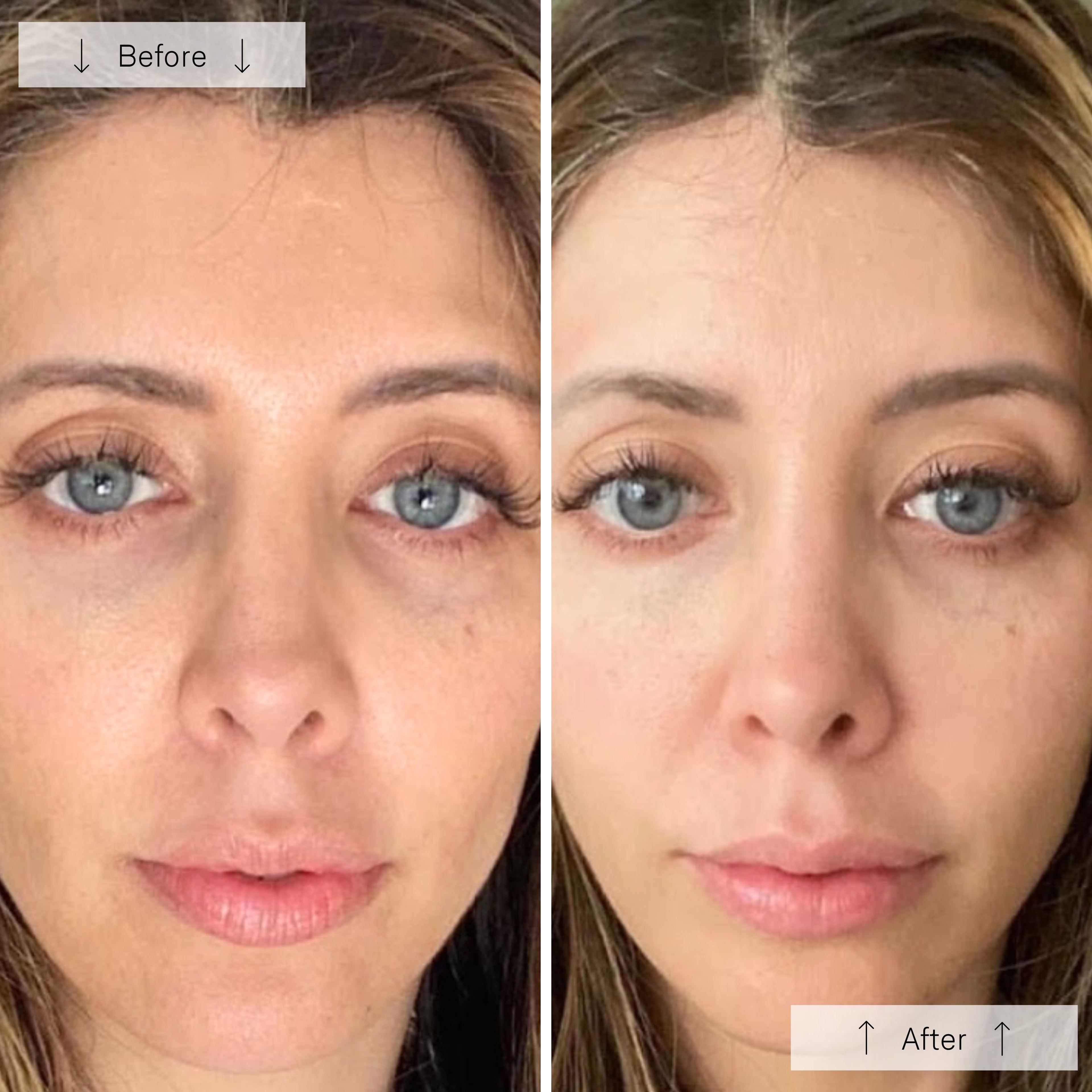 Elyra Light Mask