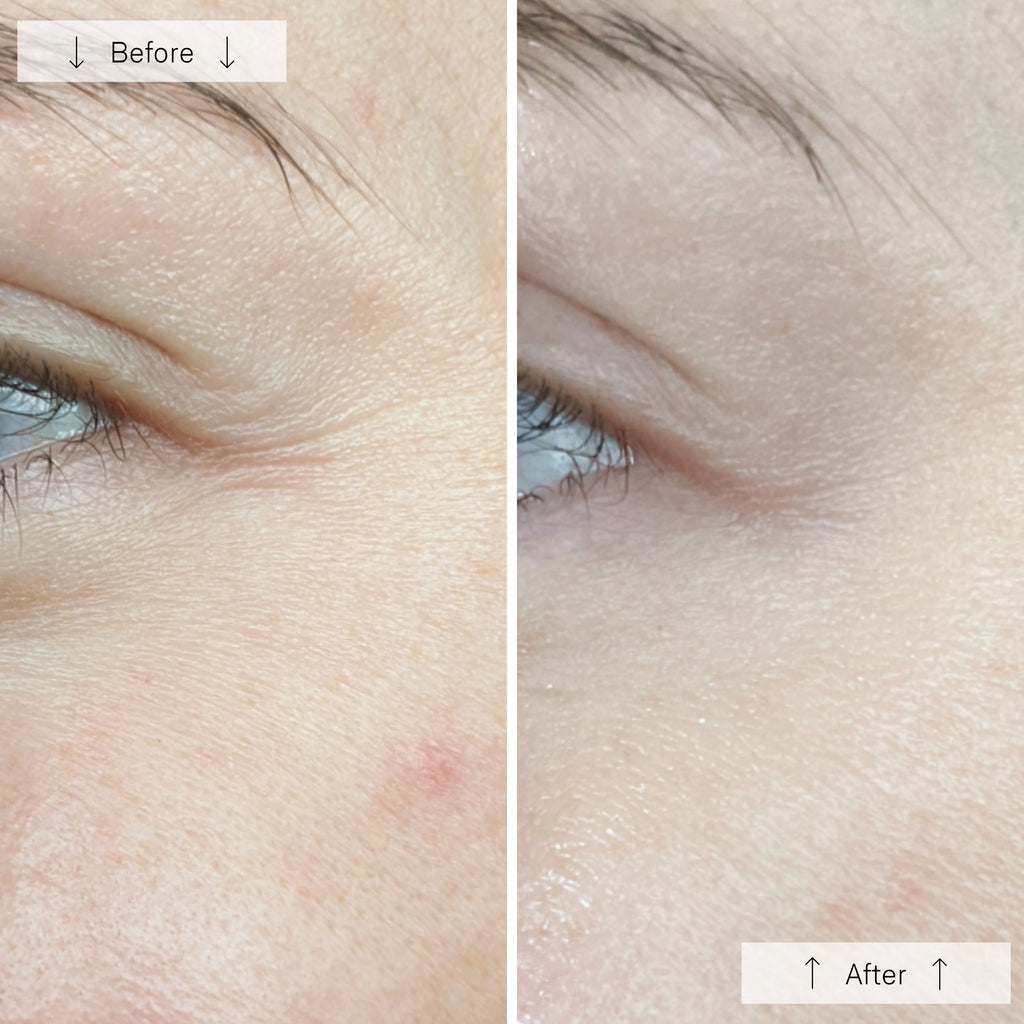 Elyra Light Mask