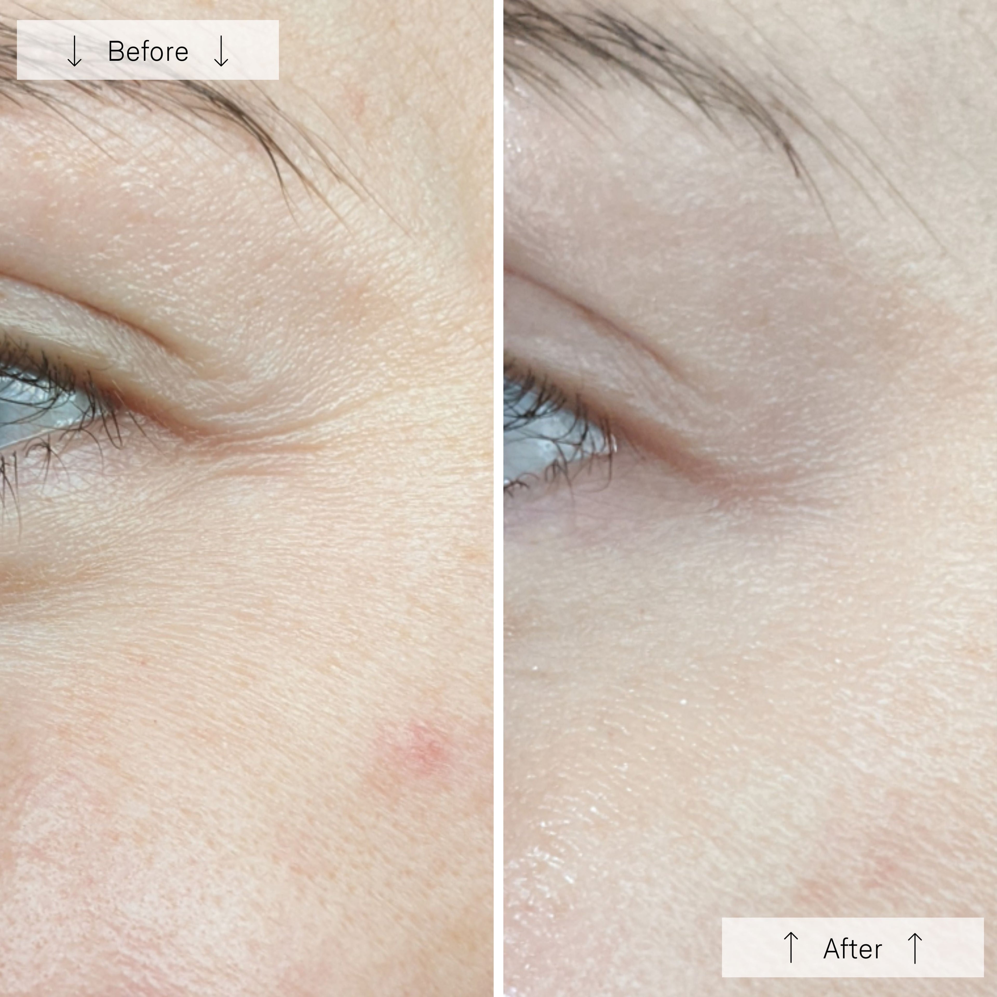 Elyra Light Mask